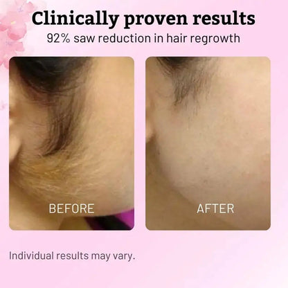 After Hair Removal Serum