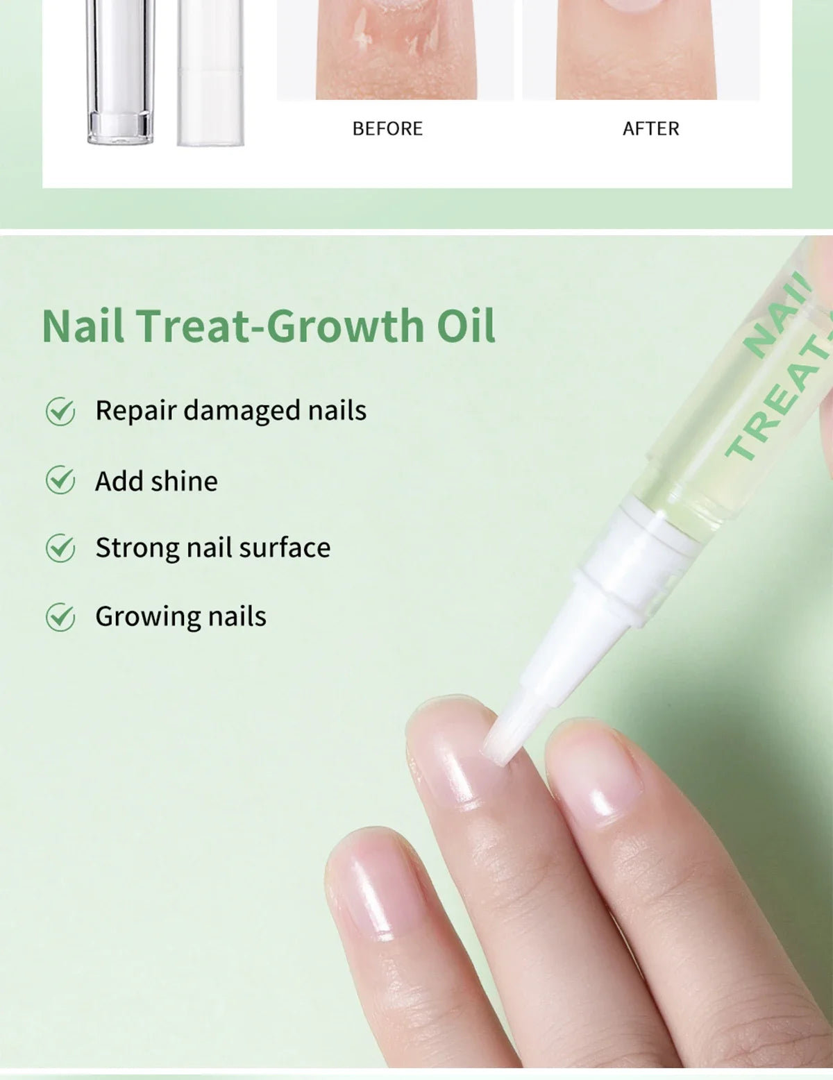 Nail Treat -Growth Nail Strengthener Health Strong Nail Growth Oil Help Splits Thin Nails Repair Manicure Nails Hongos Uñas Pies