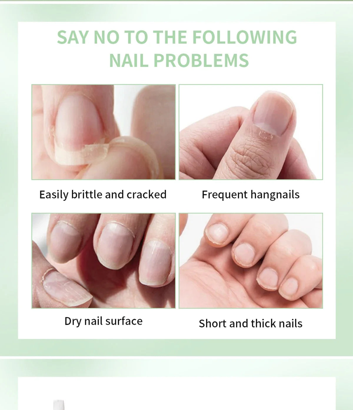 Nail Treat -Growth Nail Strengthener Health Strong Nail Growth Oil Help Splits Thin Nails Repair Manicure Nails Hongos Uñas Pies