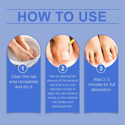 Nail Fungus Care Solution Anti-Infection Onychomycosis Repair Damaged Cracked Hand Foot Nail Manicureed Health Care Essence 50ml