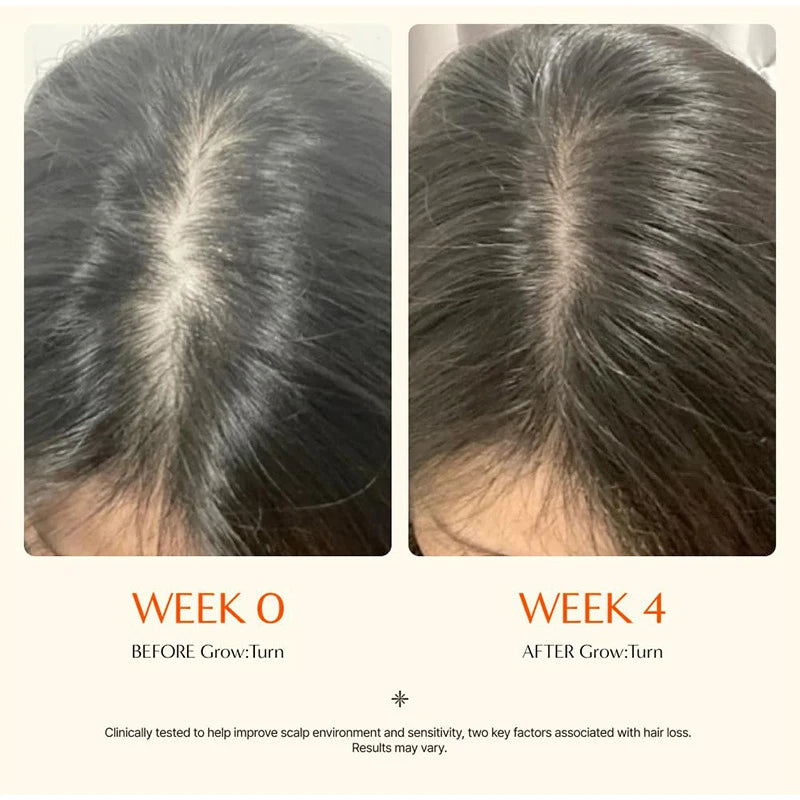 Hair Serum with Built-In Brush – Scalp Strengthening Essence