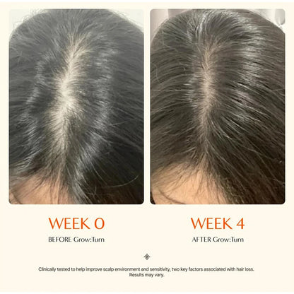 Hair Serum with Built-In Brush – Scalp Strengthening Essence