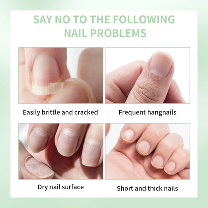Nail Treat -Growth Nail Strengthener Health Strong Nail Growth Oil Help Splits Thin Nails Repair Manicure Nails Hongos Uñas Pies