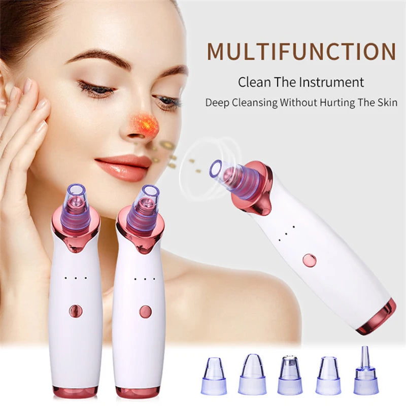 Blackhead Remover Vacuum – Electric Pore Cleanser for Clear Skin