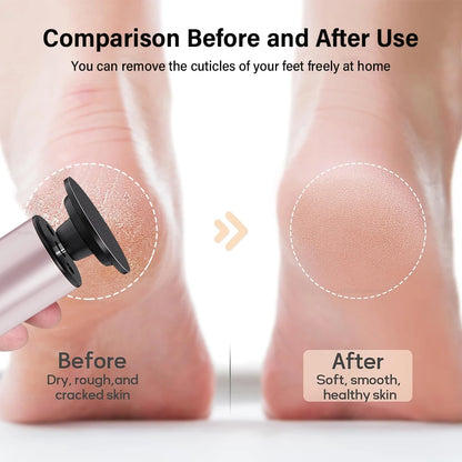 Electric Callus Remover 