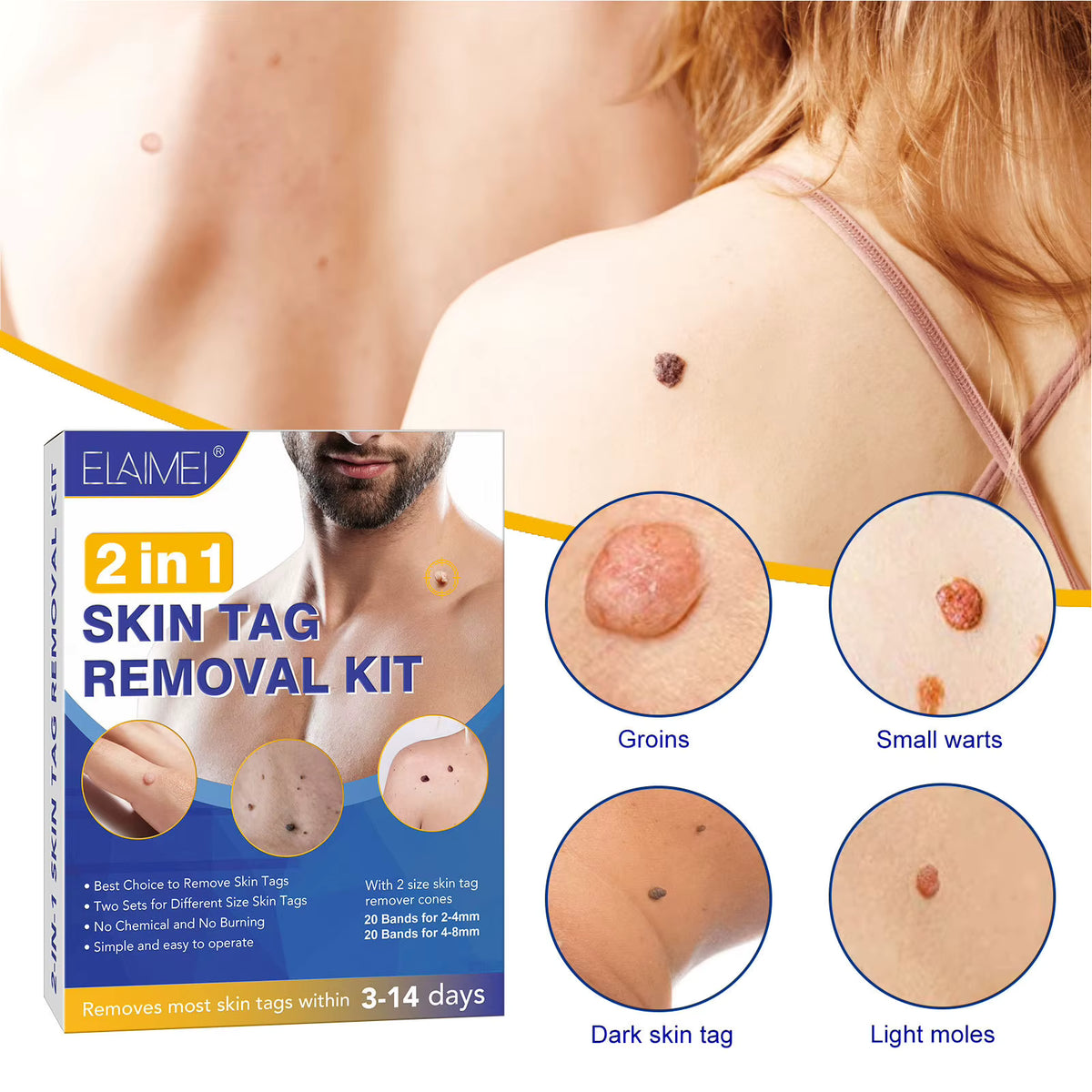 Elaine 2-in-1 Skin Tag Remover Kit packaging with images of skin tags on different body parts.