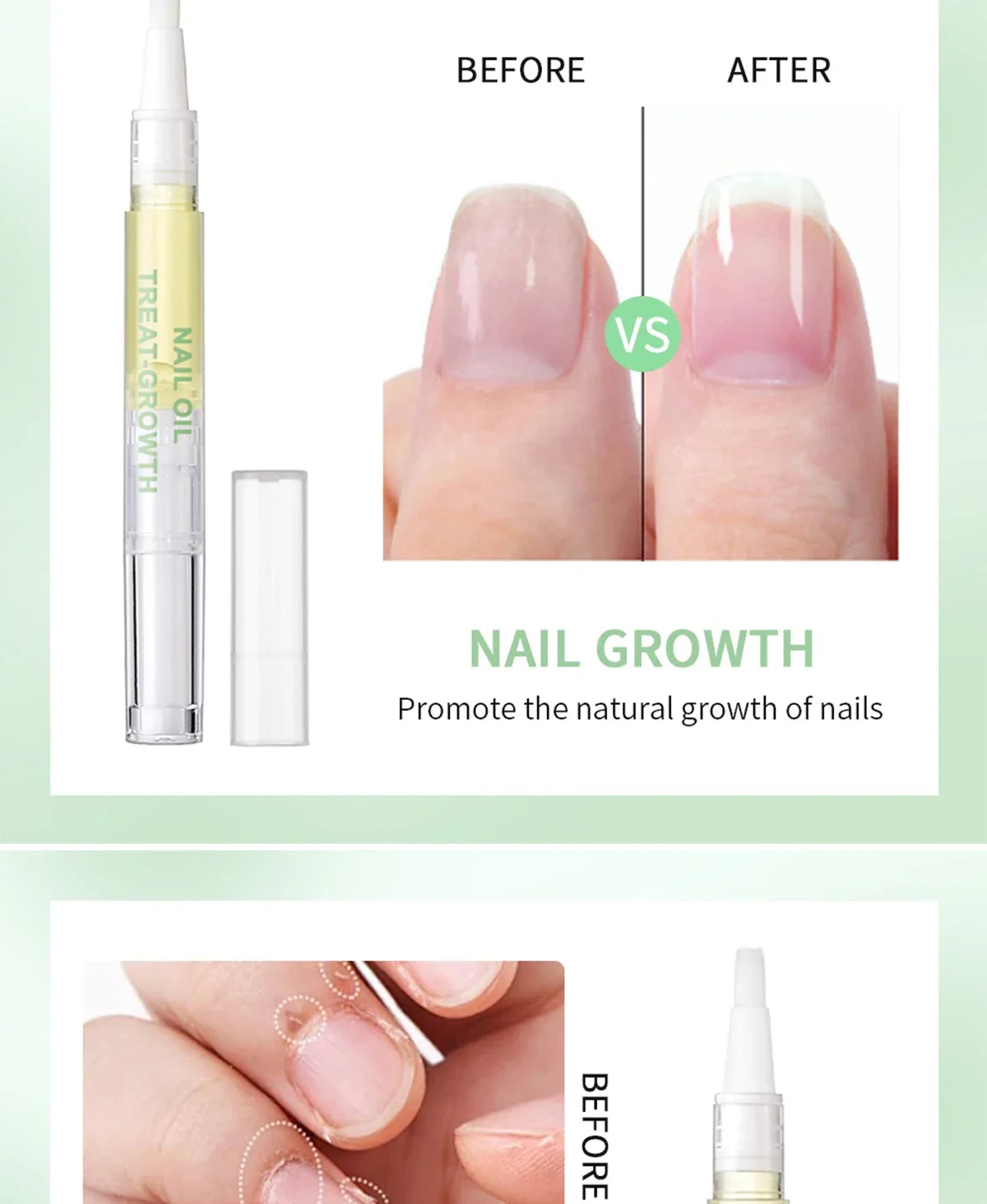Nail Treat -Growth Nail Strengthener Health Strong Nail Growth Oil Help Splits Thin Nails Repair Manicure Nails Hongos Uñas Pies