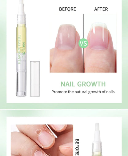 Nail Treat -Growth Nail Strengthener Health Strong Nail Growth Oil Help Splits Thin Nails Repair Manicure Nails Hongos Uñas Pies