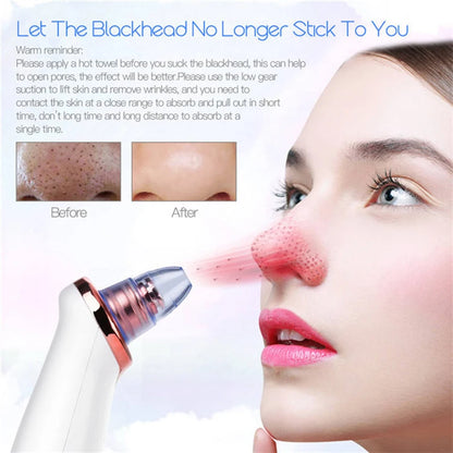 Blackhead Remover Vacuum – Electric Pore Cleanser for Clear Skin